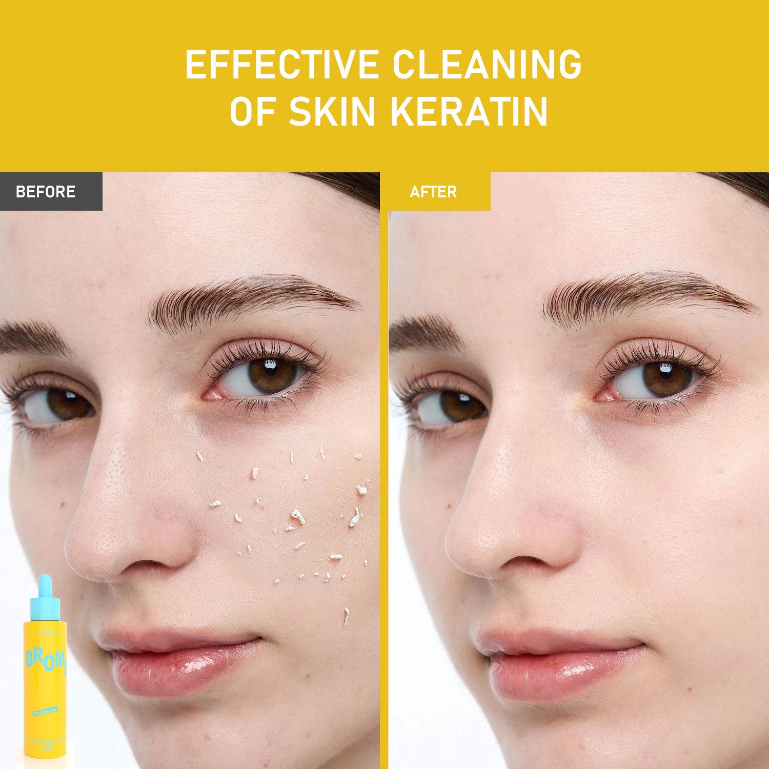 PHOFAY SANFTES PEELING‑SOLUTION mit Papaya‑Enzymen, AHA und BHA